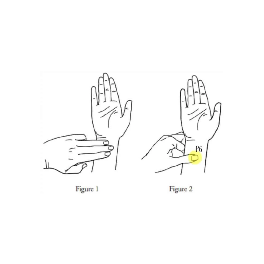 Pregnancy Nausea Relief Bands (Acupressure Wristbands)