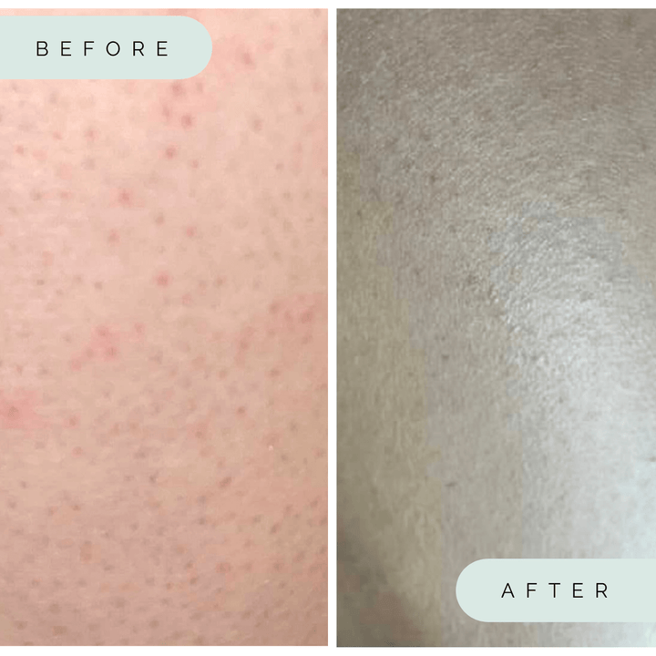 Wildpier™️ Luxe Deep Exfoliating Glove